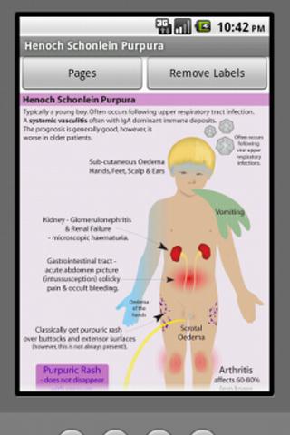 Picturing SYNDROMES