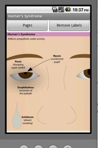 Picturing SYNDROMES